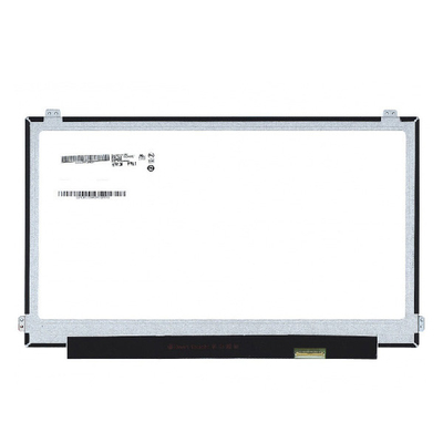 B156ZAN02.1 ขนาด 15.6 นิ้ว 16.7M 60Hz LCD Moudle สําหรับ AUO